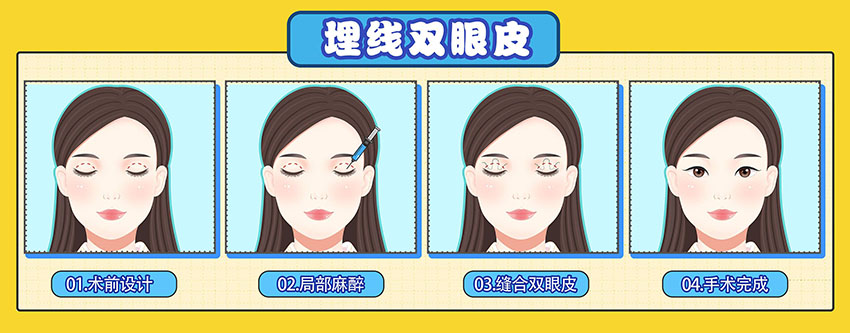 1658367063435901.jpg 48328a60d5f0419a026f98e5eb739004.jpg