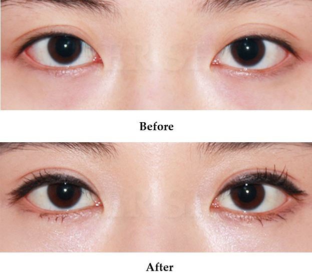 1658453743120994.jpg e136491a7a72b4cf70fd438823c76e7d.jpg