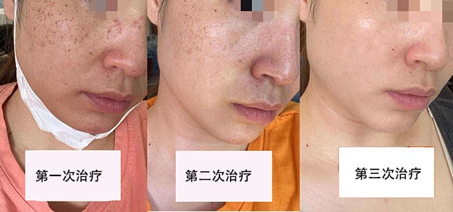 1658541056810670.jpg a1582600641d05376cef3ae8801304f5.jpg