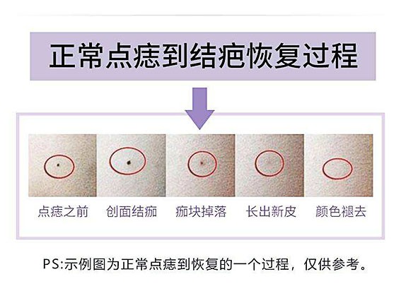 1658713367175107.jpg 7ca9a5897699eb7ffaebb0a8fda91b8e.jpg