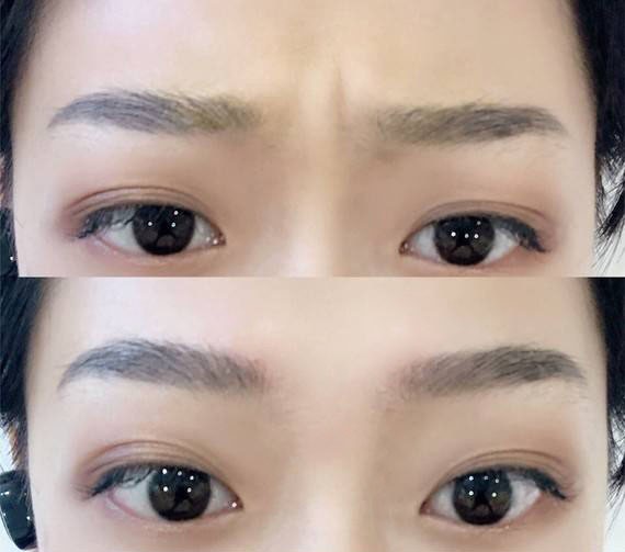 1658713630180560.jpg f817be9465d6586d99f2bea44c280e5a.jpg