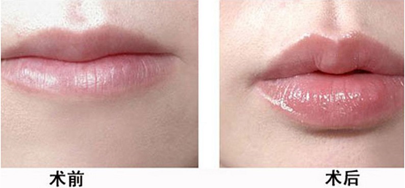 1658885410187590.jpg 2a4bb9937349d2be31823f7903b3f315 拷贝.jpg