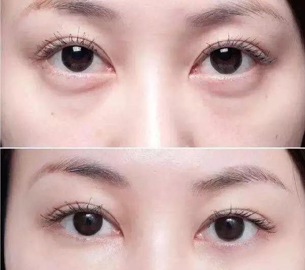 1658885969705438.jpg 7cdc80cae4ce133a4b23aaf93243553b.jpg