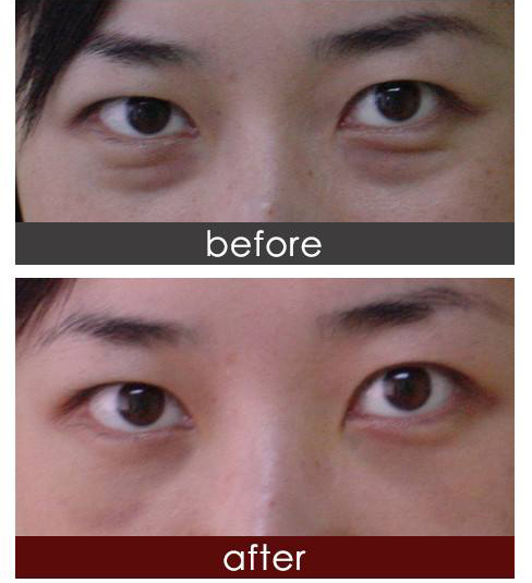 1659749917673570.jpeg 5a3b7e98540a4cd53166b1e09af73e96.jpeg