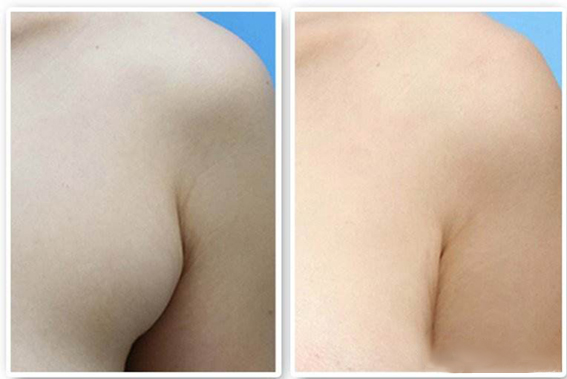 1659922955188748.jpeg 519769f0a6a453c840582e393ab31954.jpeg