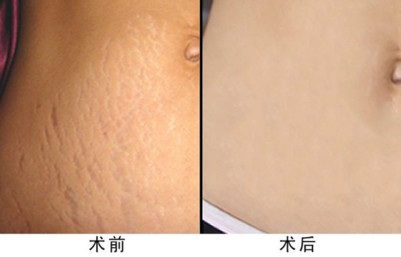 1660182494157284.jpeg f1aa8e089d476e183effcbb25df2c084.jpeg