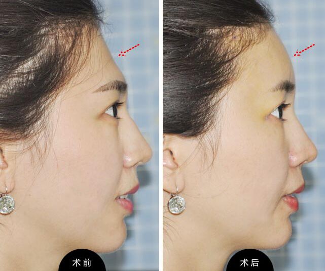 1661477752279507.jpeg 179f1e49d4eadc2c3adb127eedc47814.jpeg