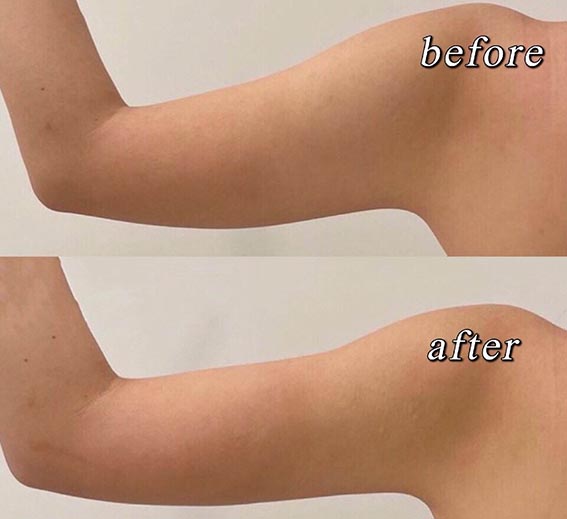 1661910161188408.jpeg fd519503bf5a9437c16b0d80e8a3e512.jpeg