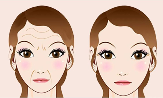 1680139229444020.jpeg 去眉间纹的方法有哪些?去眉间纹后怎么护理?