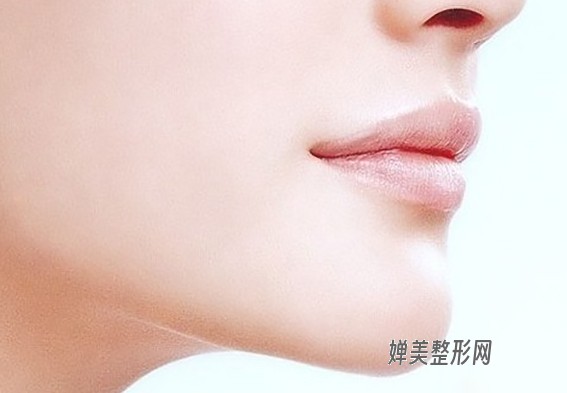 1680572048129792.jpg 玻尿酸垫下巴效果好不好?玻尿酸垫下巴有哪些优点?