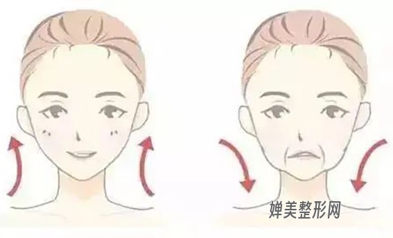 1681089654173699.jpg 去法令纹的方法有哪些?去法令纹有哪些注意事项?