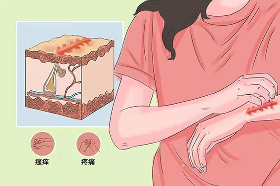 1681089987200477.jpeg 激光祛疤要多少费用?激光祛疤效果怎么样?