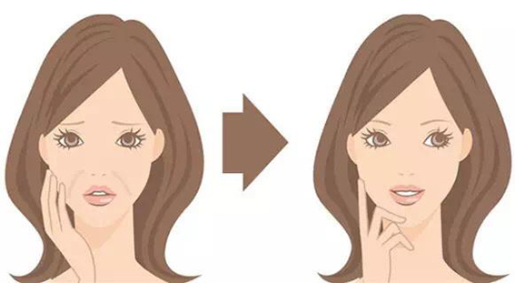 1681176022106777.jpeg 去法令纹的方法有哪些?玻尿酸去法令纹效果好不好?