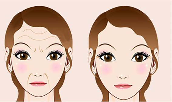 1681521968206873.jpeg 玻尿酸去抬头纹效果怎么样?玻尿酸去抬头纹要注意哪些问题?