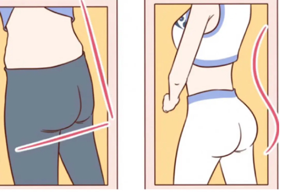 1681694926175183.jpeg 自体脂肪丰臀有哪些优点?自体脂肪丰臀后怎么护理?