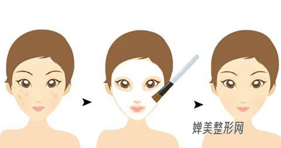 1681695071388306.jpg 果酸焕肤效果好不好?果酸焕肤要多少费用?