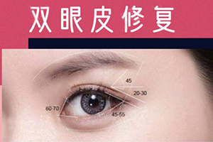 北京双眼皮修复那个专家好 美莱杜圆圆 眼部修复金手指美誉