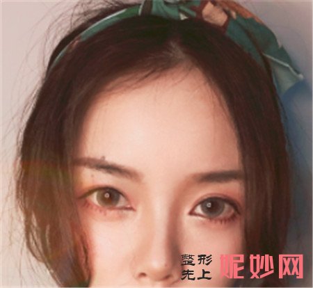 到湘雅二医院整形科找贺吉庸做的肋软骨隆鼻怎么样?真人案例分享