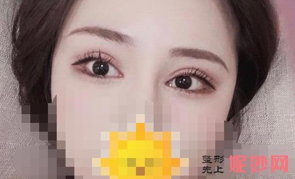 上海首尔丽格医疗美容医院怎么样?医院介绍,副双眼皮修复案例及价格表!
