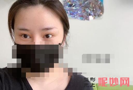 上海首尔丽格医疗美容医院怎么样?医院介绍,副双眼皮修复案例及价格表!