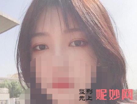 上海华美医疗美容医院好吗?医院介绍,附双眼皮整形案例和价格表!