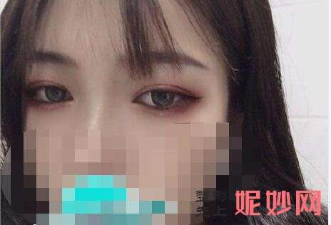 上海华美医疗美容医院好吗?医院介绍,附双眼皮整形案例和价格表!