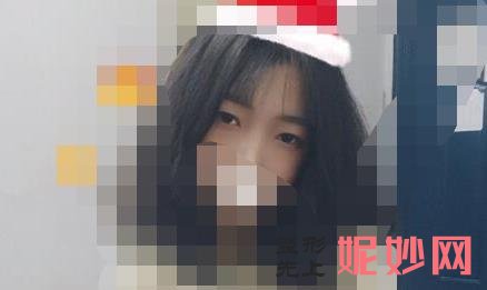 上海华美医疗美容医院好吗?医院介绍,附双眼皮整形案例和价格表!