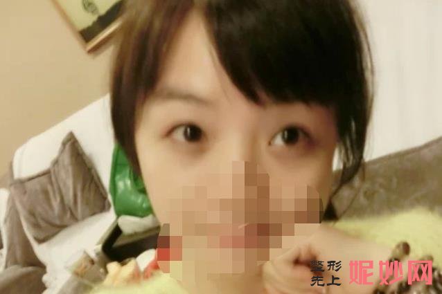 北京禾美嘉医疗整形门诊部怎么样,医院介绍,附双眼皮案例分享和价格表!