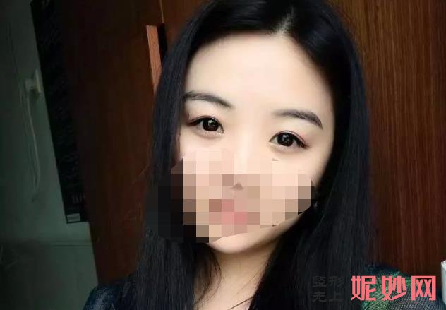 北京禾美嘉医疗整形门诊部怎么样,医院介绍,附双眼皮案例分享和价格表!