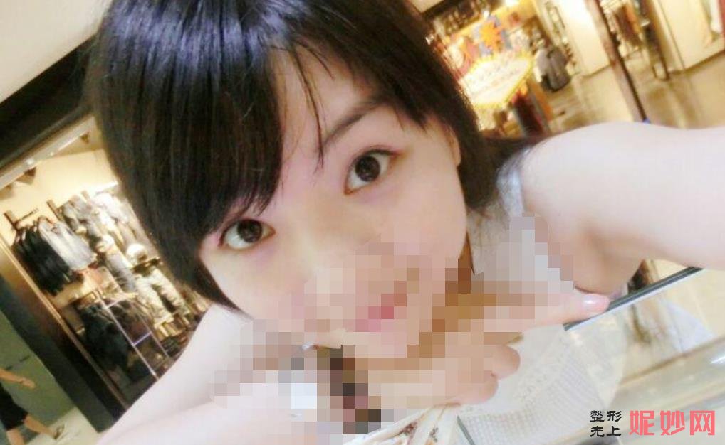 北京禾美嘉医疗整形门诊部怎么样,医院介绍,附双眼皮案例分享和价格表!