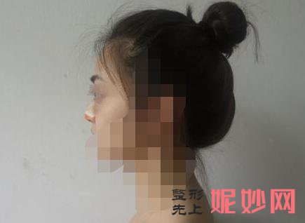 北京美莱医疗美容怎么样,医院介绍,附隆鼻修复案例分享和价格表!