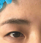 北京清木医疗美容诊所怎么样?附案例分析和价格表