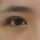 北京清木医疗美容诊所怎么样?附案例分析和价格表