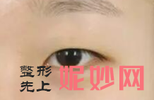 北京伟力嘉美信医疗美容医院技术如何?附案例分析和价格表