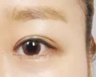 北京伟力嘉美信医疗美容医院技术如何?附案例分析和价格表