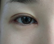 北京新星靓医疗美容医院怎么样?附案例分析和价格表