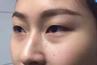 上海愉悦美联臣医疗美容医院技术怎么样?附案例分析和价格表