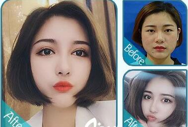 南宁达美整形医院如何?了解清楚达美这些信息,最终我这样决定