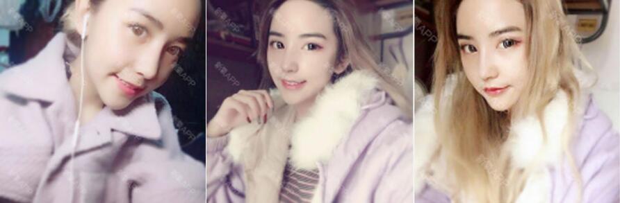 南宁梦想鼻整形医生整救颜面之王,让你无可“鼻”拟