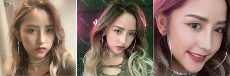 南宁梦想鼻整形医生整救颜面之王,让你无可“鼻”拟