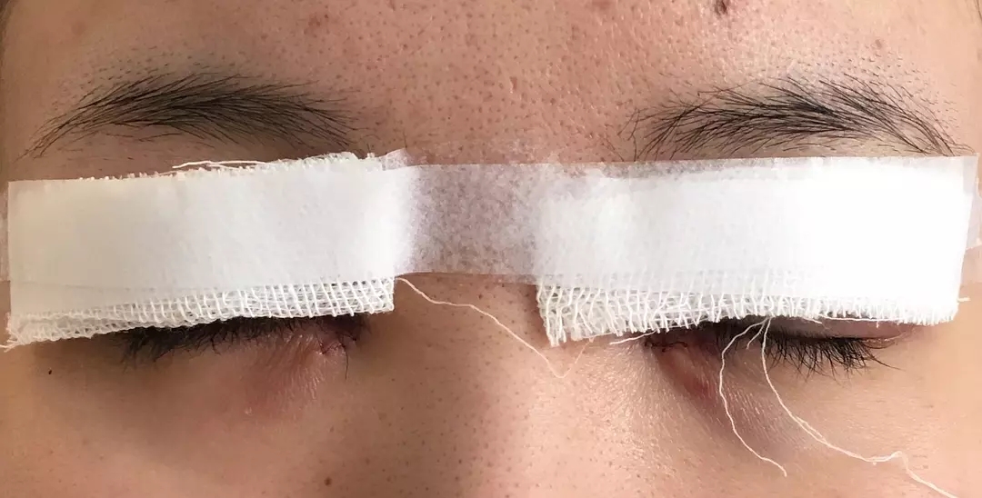 青岛壹美整形是正规医院吗?解密真实的壹美整形