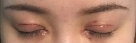 青岛壹美整形是正规医院吗?解密真实的壹美整形