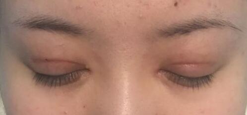 青岛壹美整形是正规医院吗?解密真实的壹美整形