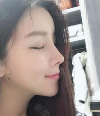 成都美莱是正规三甲医院吗?整形怎么样?附美莱医生案例效果图及价格表