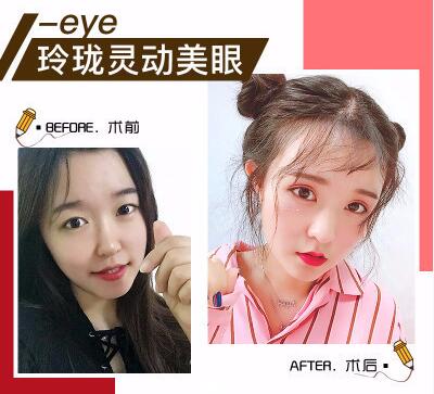 深圳希思是几级医院?正规的吗?整形怎么样?深圳希思医生案例效果图及价格表