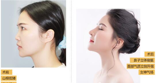 深圳希思是几级医院?正规的吗?整形怎么样?深圳希思医生案例效果图及价格表