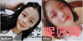 山东威海美神整形正规,不拉人头附威海美神技术怎么样_案例_价格表