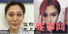 山东威海美神整形正规,不拉人头附威海美神技术怎么样_案例_价格表