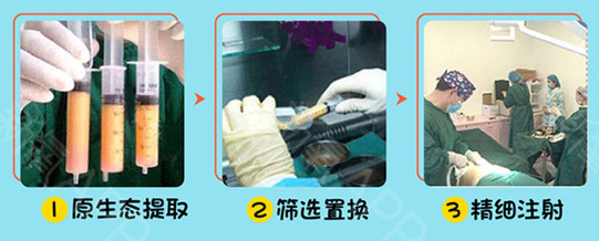 哈尔滨欧兰仁美医院:全面部填充一次体验 即可定格面部美丽