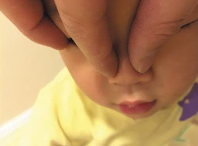 武汉美莱徐国建医生告诉你到底山根高好不好?